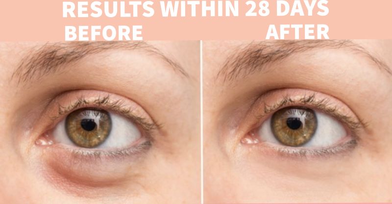Ser Anti-Cearcane Nature Spell Watermelon Under Eye Serum